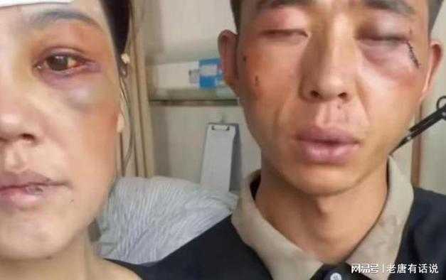 顶嘴被主人打到脸肿:主人太过分